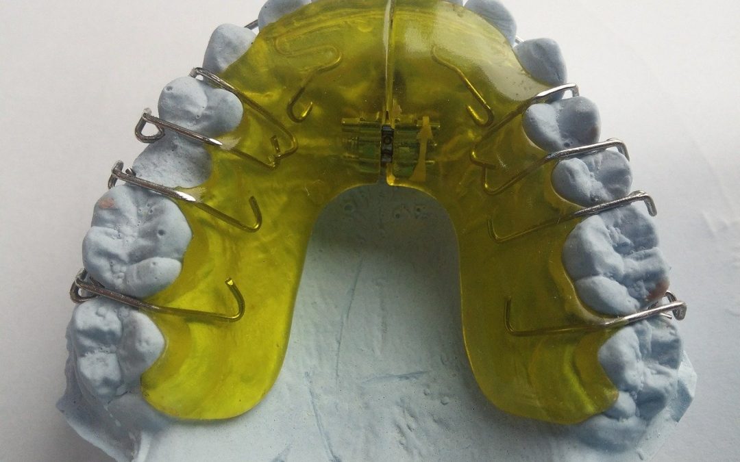 Tratamientos de ortodoncia, según el desarrollo dental